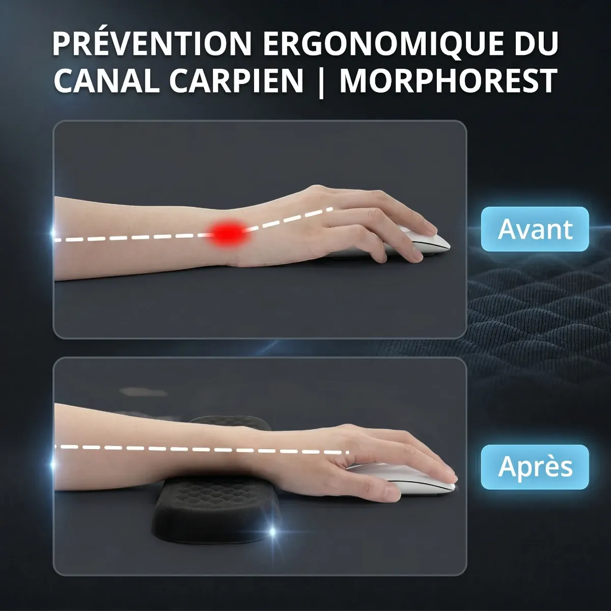 Comparatif avant et après l'utilisation du repose poignet clavier / souris MorphoRest pour un alignement neutre du canal carpien.